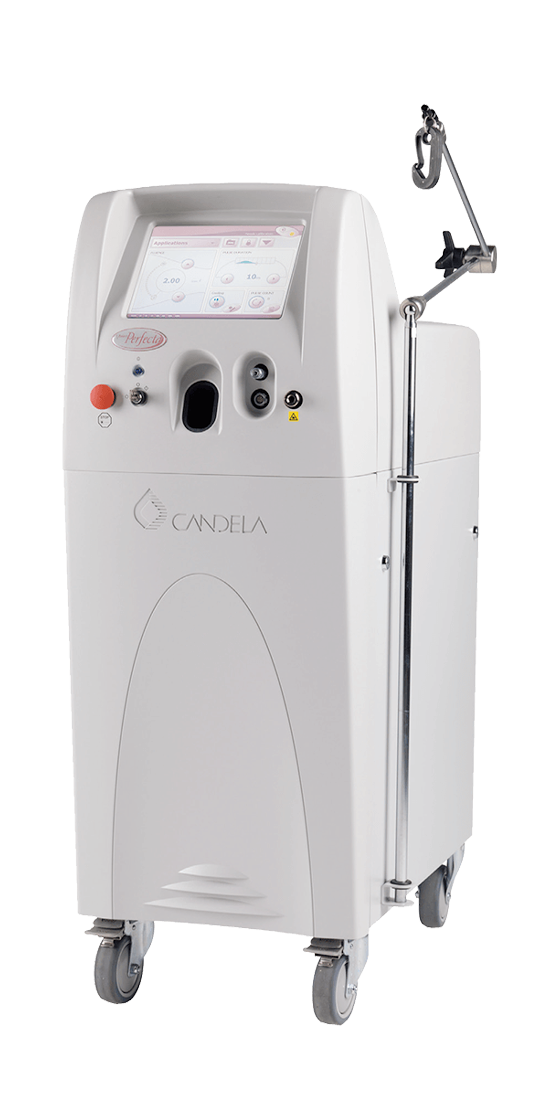 vbeam perfecta candela