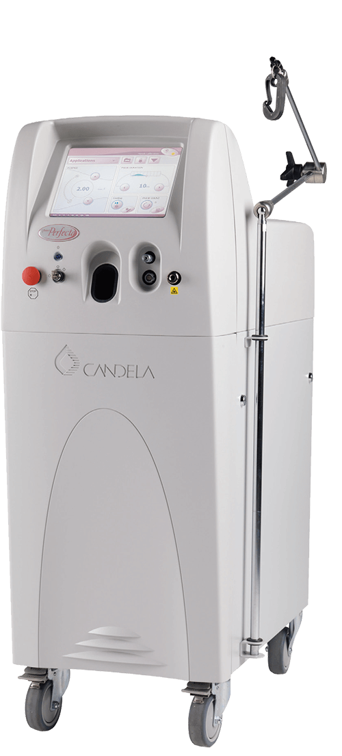 vbeam perfecta candela